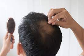 Head & Hair - erfahrungen - bewertung - test - Stiftung Warentest